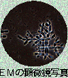EMの顕微鏡写真